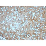 Immunohistochemistry - Anti-67kDa Laminin Receptor Antibody [rRPSA/6333] - BSA and Azide free (A252405) - Antibodies.com