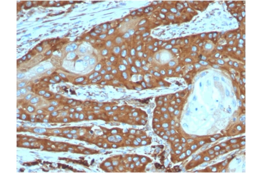 Immunohistochemistry - Anti-67kDa Laminin Receptor Antibody [rRPSA/6333] - BSA and Azide free (A252404) - Antibodies.com