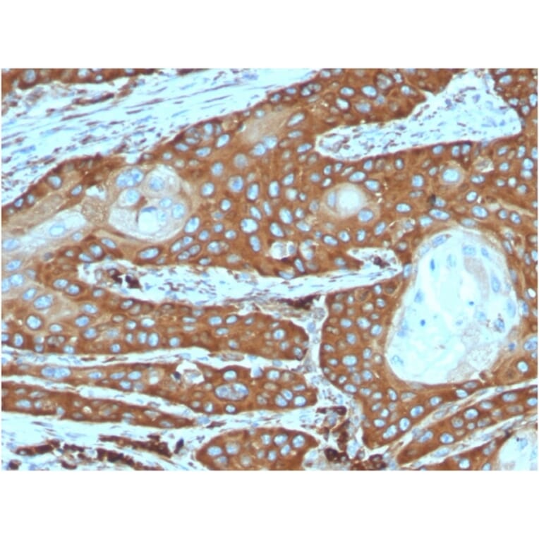 Immunohistochemistry - Anti-67kDa Laminin Receptor Antibody [rRPSA/6333] - BSA and Azide free (A252404) - Antibodies.com
