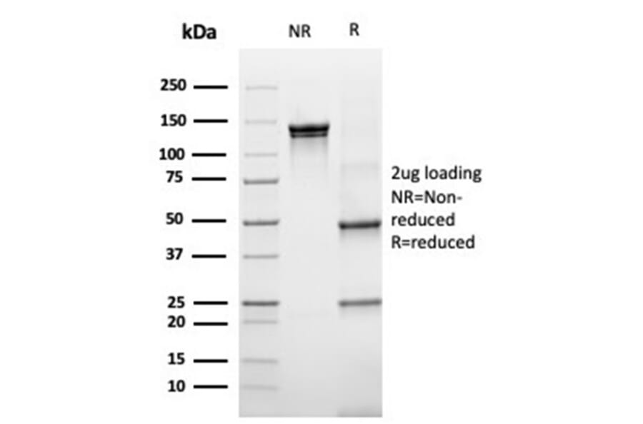 SDS-PAGE - Anti-67kDa Laminin Receptor Antibody [rRPSA/6333] - BSA and Azide free (A252405) - Antibodies.com