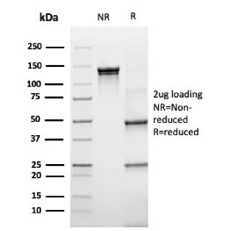 SDS-PAGE - Anti-67kDa Laminin Receptor Antibody [rRPSA/6333] - BSA and Azide free (A252405) - Antibodies.com