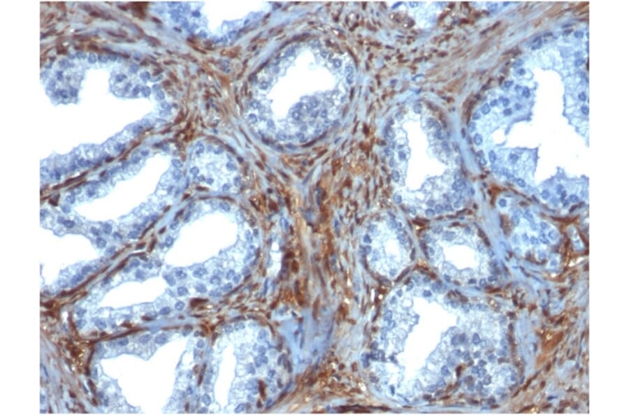 Immunohistochemistry - Anti-Galectin 1 Antibody [GAL1/1831] - BSA and Azide free (A252406) - Antibodies.com