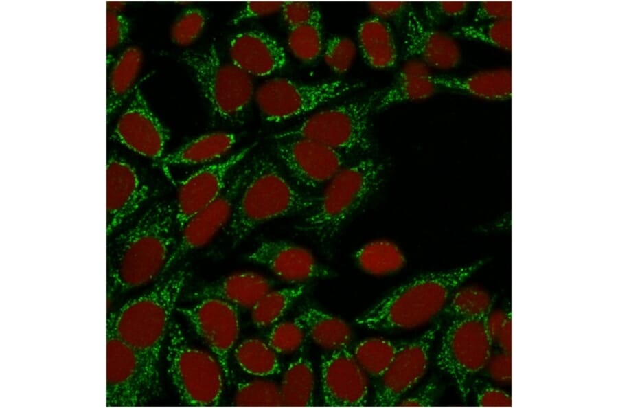 Immunofluorescence - Anti-Galectin 1 Antibody [GAL1/1831] - BSA and Azide free (A252406) - Antibodies.com