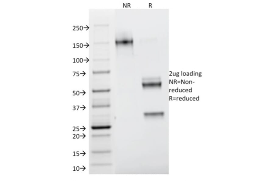 SDS-PAGE - Anti-Galectin 1 Antibody [GAL1/1831] - BSA and Azide free (A252406) - Antibodies.com