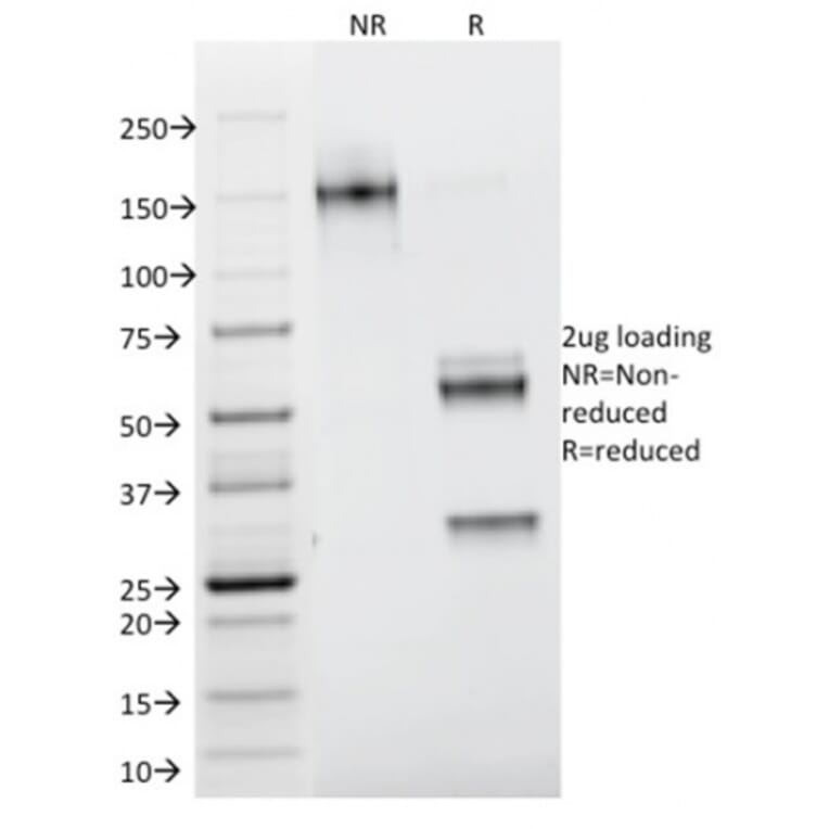 SDS-PAGE - Anti-Galectin 1 Antibody [GAL1/1831] - BSA and Azide free (A252406) - Antibodies.com