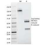 SDS-PAGE - Anti-Galectin 1 Antibody [GAL1/1831] - BSA and Azide free (A252406) - Antibodies.com