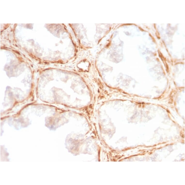 Immunohistochemistry - Anti-Galectin 1 Antibody [GAL1/2499R] - BSA and Azide free (A252407) - Antibodies.com