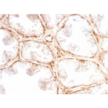 Immunohistochemistry - Anti-Galectin 1 Antibody [GAL1/2499R] - BSA and Azide free (A252407) - Antibodies.com