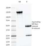 SDS-PAGE - Anti-Luteinizing Hormone beta Antibody [LHb/1214] - BSA and Azide free (A252408) - Antibodies.com
