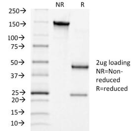 SDS-PAGE - Anti-Luteinizing Hormone Antibody [LHCGR/1415] - BSA and Azide free (A252409) - Antibodies.com