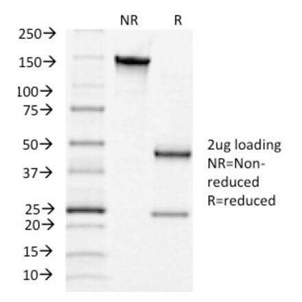 SDS-PAGE - Anti-Luteinizing Hormone Antibody [LHCGR/1415] - BSA and Azide free (A252409) - Antibodies.com