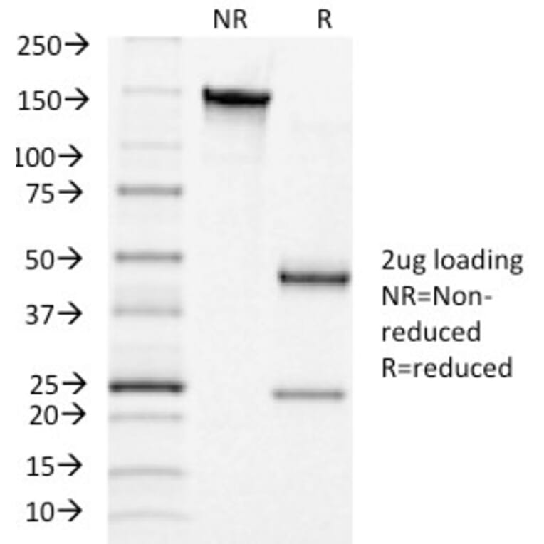 SDS-PAGE - Anti-Luteinizing Hormone Antibody [LHCGR/1415] - BSA and Azide free (A252409) - Antibodies.com