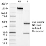 SDS-PAGE - Anti-Luteinizing Hormone Antibody [LHCGR/1415] - BSA and Azide free (A252409) - Antibodies.com