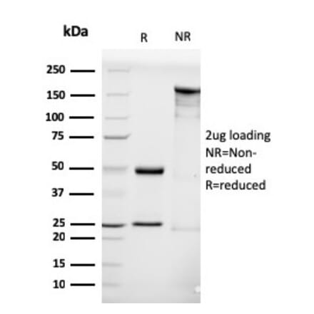 SDS-PAGE - Anti-Luteinizing Hormone Antibody [LHCGR/1416] - BSA and Azide free (A252410) - Antibodies.com