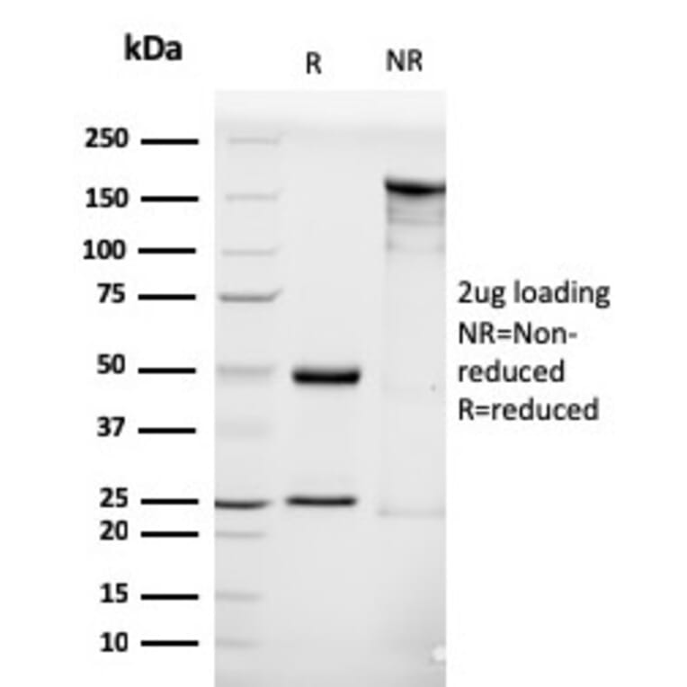 SDS-PAGE - Anti-Luteinizing Hormone Antibody [LHCGR/1416] - BSA and Azide free (A252410) - Antibodies.com