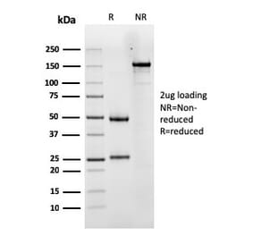 SDS-PAGE - Anti-Luteinizing Hormone Antibody [LHCGR/1417] - BSA and Azide free (A252411) - Antibodies.com
