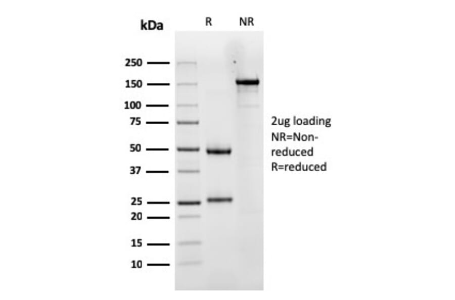 SDS-PAGE - Anti-Luteinizing Hormone Antibody [LHCGR/1417] - BSA and Azide free (A252411) - Antibodies.com