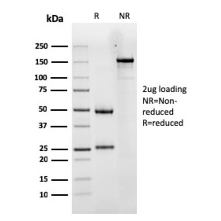 SDS-PAGE - Anti-Luteinizing Hormone Antibody [LHCGR/1417] - BSA and Azide free (A252411) - Antibodies.com