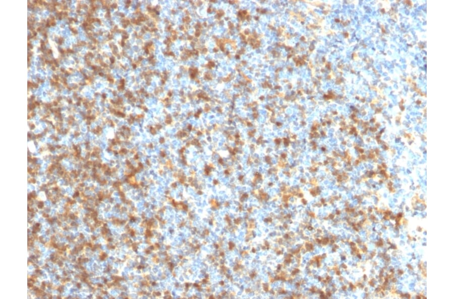 Immunohistochemistry - Anti-LMO2 Antibody [LMO2/1971] - BSA and Azide free (A252414) - Antibodies.com