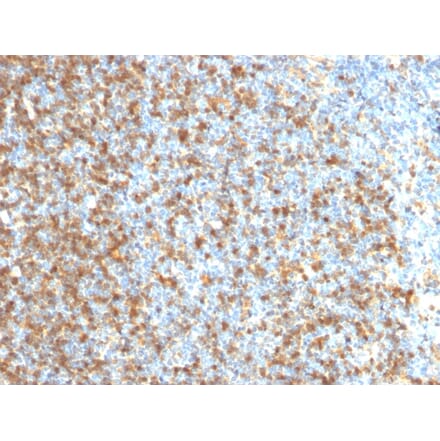 Immunohistochemistry - Anti-LMO2 Antibody [LMO2/1971] - BSA and Azide free (A252414) - Antibodies.com