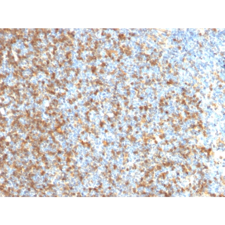 Immunohistochemistry - Anti-LMO2 Antibody [LMO2/1971] - BSA and Azide free (A252414) - Antibodies.com