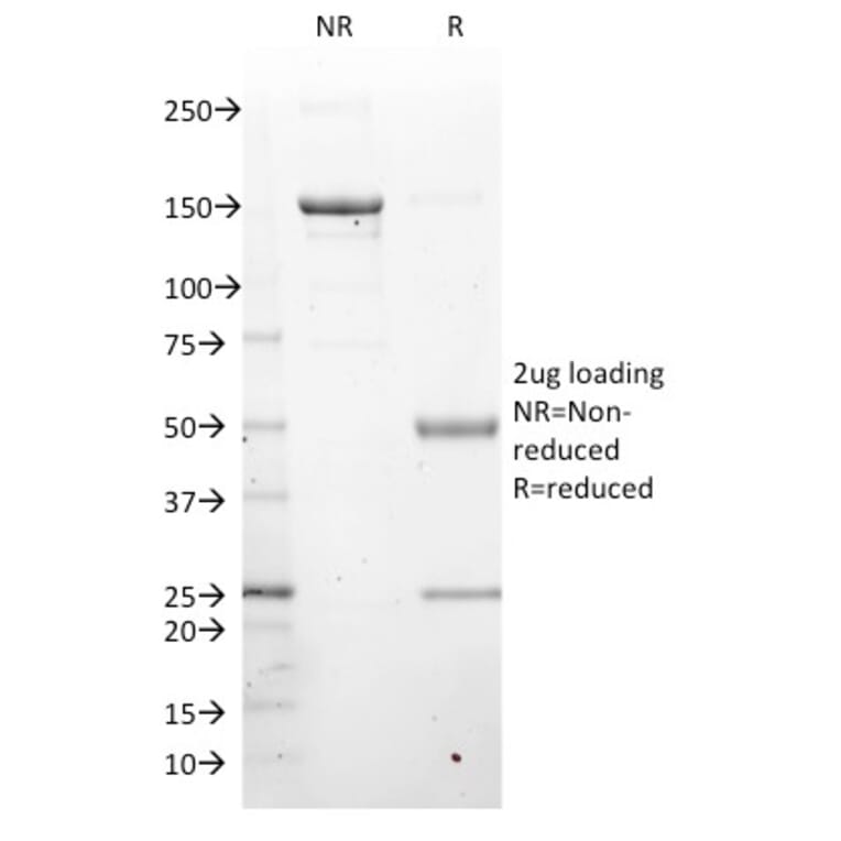 SDS-PAGE - Anti-LMO2 Antibody [LMO2/1971] - BSA and Azide free (A252414) - Antibodies.com