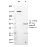 SDS-PAGE - Anti-LMO2 Antibody [LMO2/1971] - BSA and Azide free (A252414) - Antibodies.com