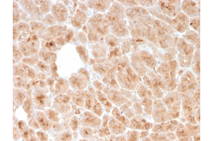 Immunohistochemistry - Anti-LMO2 Antibody [rLMO2/1971] - BSA and Azide free (A252414) - Antibodies.com