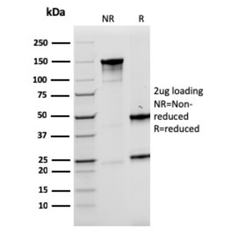 SDS-PAGE - Anti-LMO2 Antibody [rLMO2/1971] - BSA and Azide free (A252415) - Antibodies.com
