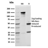 SDS-PAGE - Anti-LMO2 Antibody [rLMO2/1971] - BSA and Azide free (A252415) - Antibodies.com