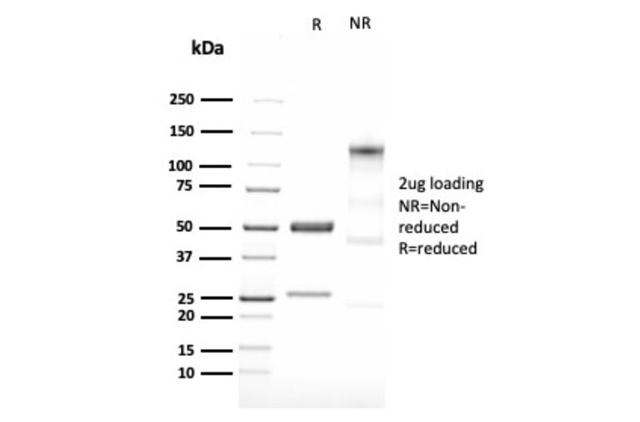 SDS-PAGE - Anti-LMO2 Antibody [LMO2/3147R] - BSA and Azide free (A252416) - Antibodies.com