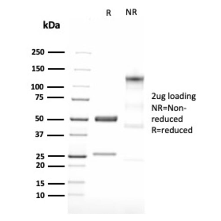 SDS-PAGE - Anti-LMO2 Antibody [LMO2/3147R] - BSA and Azide free (A252416) - Antibodies.com