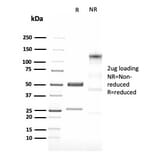 SDS-PAGE - Anti-LMO2 Antibody [LMO2/3147R] - BSA and Azide free (A252416) - Antibodies.com