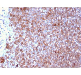 Immunohistochemistry - Anti-LSP1 Antibody [LSP1/3025] - BSA and Azide free (A252417) - Antibodies.com