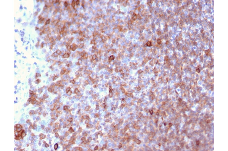 Immunohistochemistry - Anti-LSP1 Antibody [LSP1/3025] - BSA and Azide free (A252417) - Antibodies.com