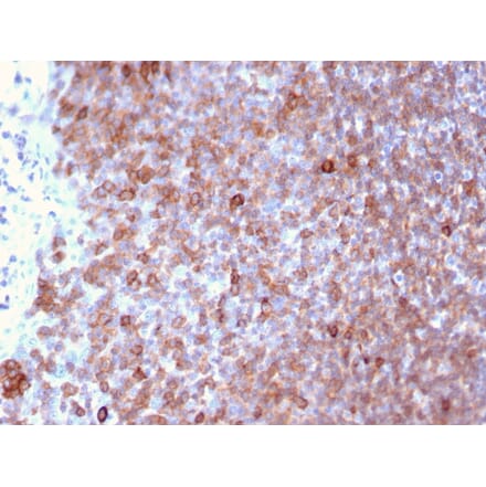 Immunohistochemistry - Anti-LSP1 Antibody [LSP1/3025] - BSA and Azide free (A252417) - Antibodies.com