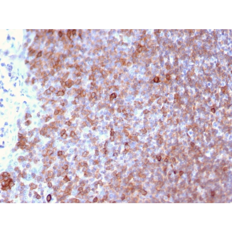 Immunohistochemistry - Anti-LSP1 Antibody [LSP1/3025] - BSA and Azide free (A252417) - Antibodies.com