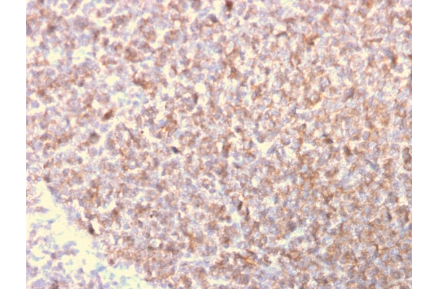 Immunohistochemistry - Anti-LSP1 Antibody [LSP1/3025] - BSA and Azide free (A252417) - Antibodies.com