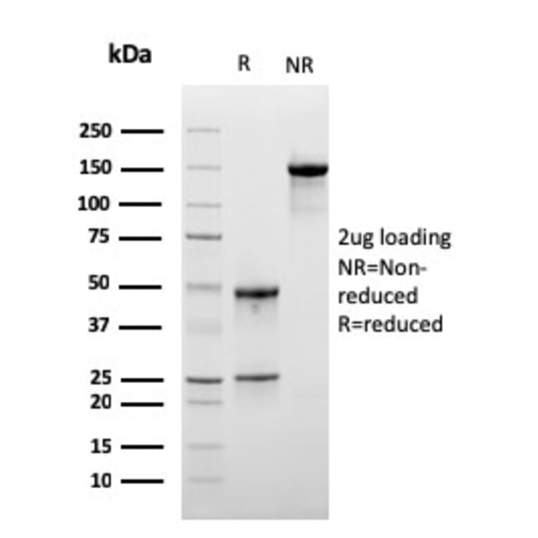 SDS-PAGE - Anti-LSP1 Antibody [LSP1/3025] - BSA and Azide free (A252417) - Antibodies.com