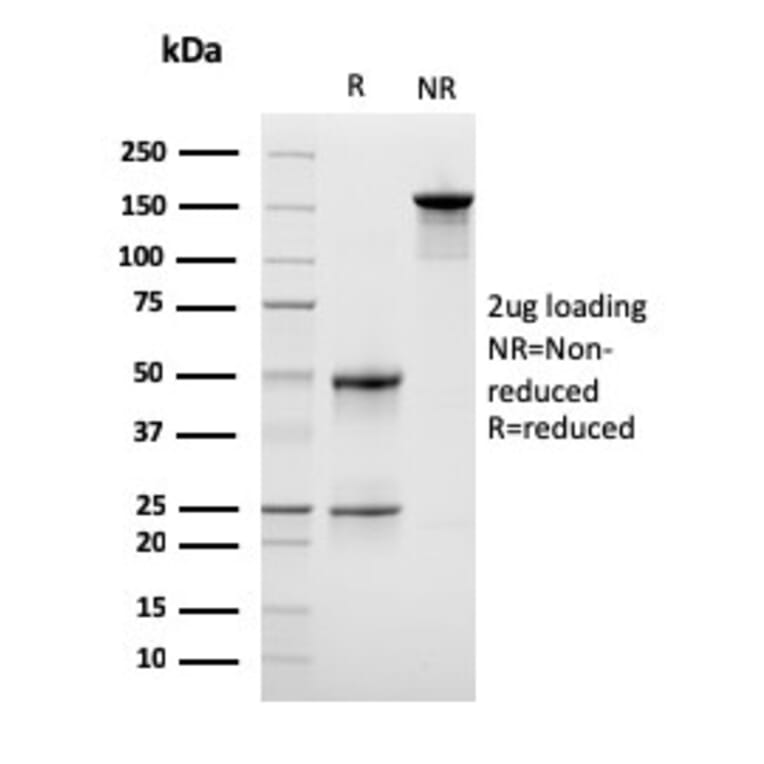 SDS-PAGE - Anti-LSP1 Antibody [LSP1/3042] - BSA and Azide free (A252418) - Antibodies.com