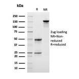 SDS-PAGE - Anti-LSP1 Antibody [LSP1/3042] - BSA and Azide free (A252418) - Antibodies.com
