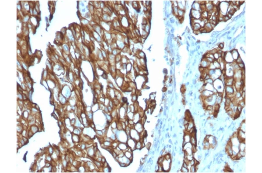 Immunohistochemistry - Anti-TROP2 Antibody [TACSTD2/2151] - BSA and Azide free (A252419) - Antibodies.com