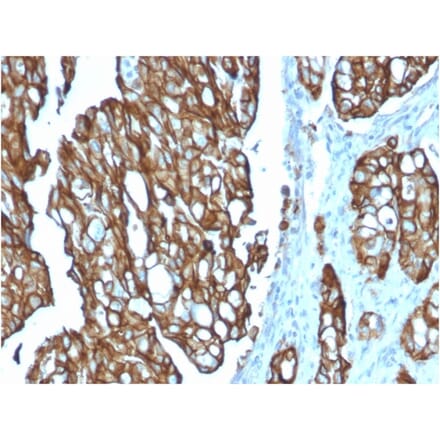 Immunohistochemistry - Anti-TROP2 Antibody [TACSTD2/2151] - BSA and Azide free (A252419) - Antibodies.com