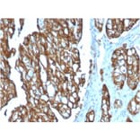 Immunohistochemistry - Anti-TROP2 Antibody [TACSTD2/2151] - BSA and Azide free (A252419) - Antibodies.com