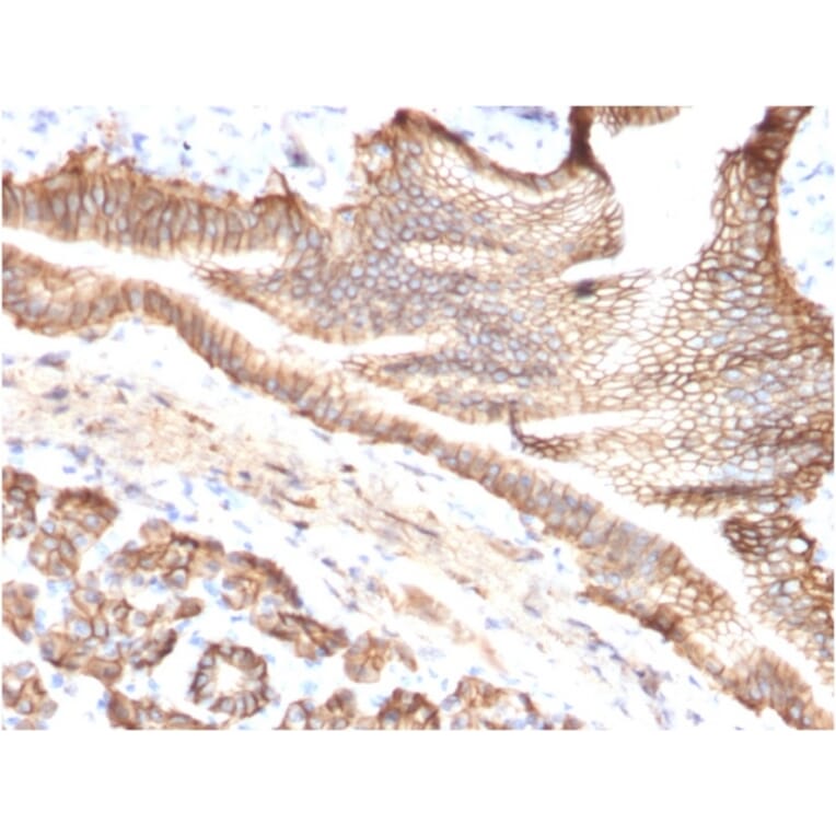 Immunohistochemistry - Anti-TROP2 Antibody [TACSTD2/2151] - BSA and Azide free (A252419) - Antibodies.com