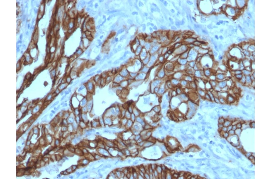 Immunohistochemistry - Anti-TROP2 Antibody [TACSTD2/2152] - BSA and Azide free (A252420) - Antibodies.com