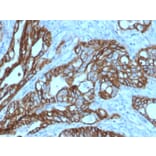 Immunohistochemistry - Anti-TROP2 Antibody [TACSTD2/2152] - BSA and Azide free (A252420) - Antibodies.com