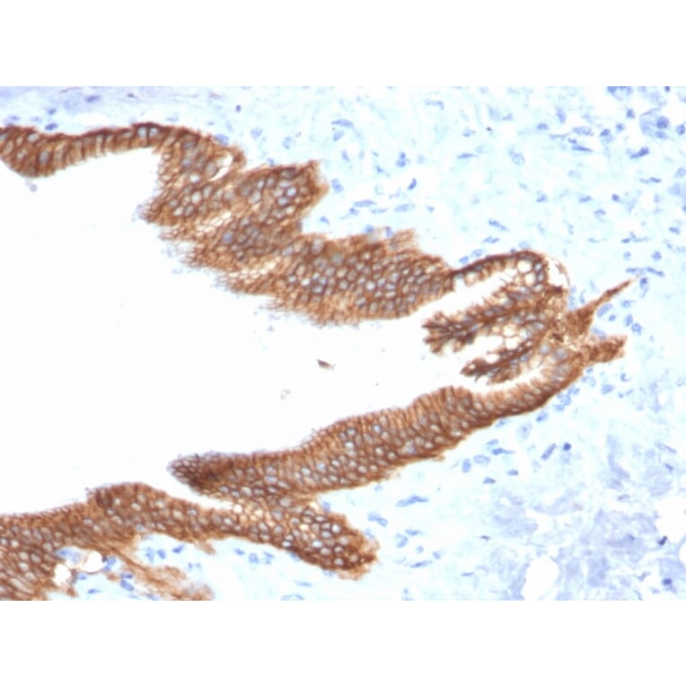 Immunohistochemistry - Anti-TROP2 Antibody [TACSTD2/2152] - BSA and Azide free (A252420) - Antibodies.com