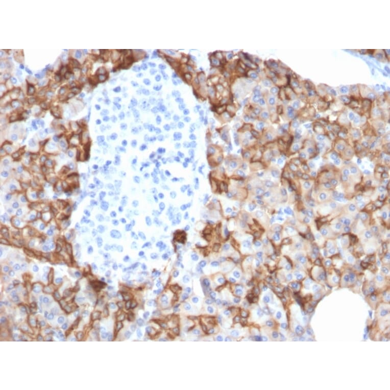 Immunohistochemistry - Anti-TROP2 Antibody [TACSTD2/2152] - BSA and Azide free (A252420) - Antibodies.com