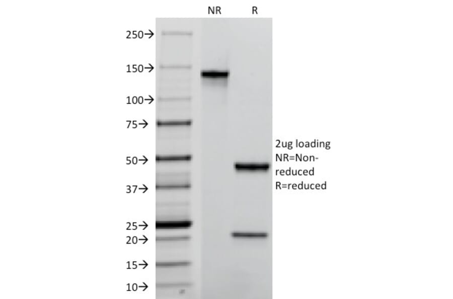SDS-PAGE - Anti-TROP2 Antibody [TACSTD2/2152] - BSA and Azide free (A252420) - Antibodies.com